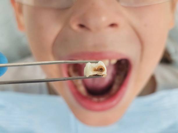 Best Emergency Cosmetic Dentistry (e.g., broken veneers) in Bermuda Run, NC