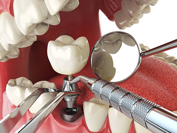 Best Emergency Treatment for Oral Infections in Bermuda Run, NC