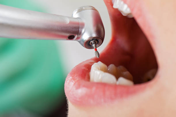 Best Walk-In Emergency Dental Services in Bermuda Run, NC